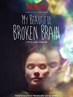 Pôster de My Beautiful Broken Brain