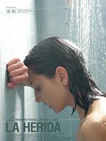 Pôster de A Ferida