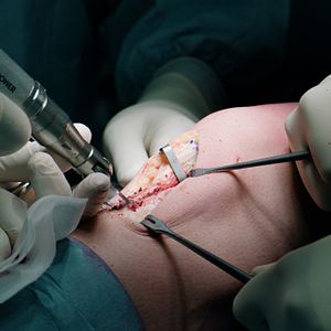 Foto Ágon - O Corpo e a Luta