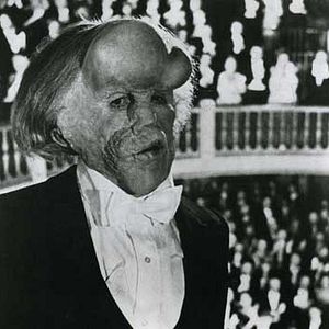 Foto O Homem Elefante