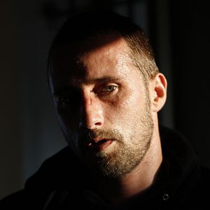 Foto Ferrugem e Osso