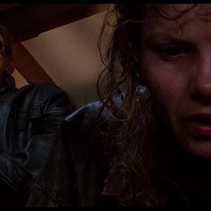 Foto Síndrome de Caim