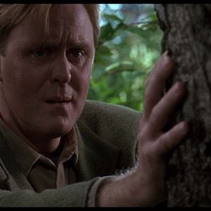 Foto Síndrome de Caim