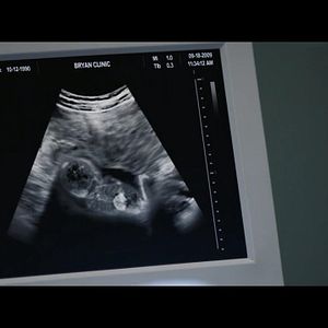 Foto 40 Dias - O Milagre da Vida