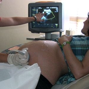 Foto Blood Money - Aborto Legalizado