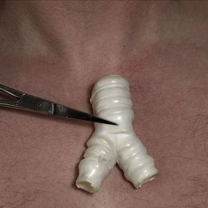 Foto Cirurgião do Mal