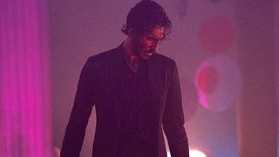 Imagem da notícia Ossos quebrados, infecção e cicatrizes: Dev Patel revela "catástrofes" impressionantes nos bastidores de seu novo filme