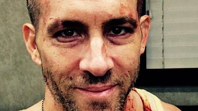 Imagem da notícia Deadpool: Ryan Reynolds publica foto sangrenta