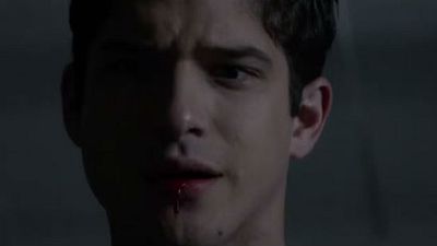 Imagem da notícia Comic-Con 2015: A situação não está nada fácil no novo trailer de Teen Wolf 