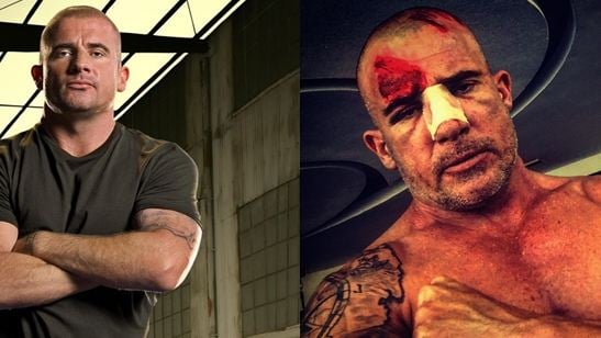 Dominic Purcell se acidenta em gravações de Prison Break