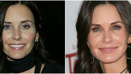 Imagem da notícia Courteney Cox revela arrependimento sobre procedimentos estéticos no passado