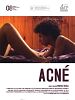 Pôster de Acne