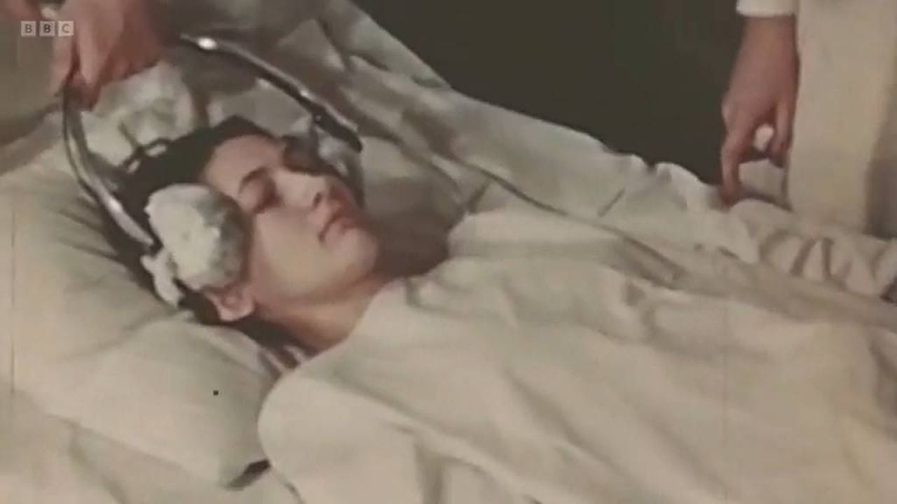 Cameron testou a terapia eletroconvulsiva com potência 30 ou 40 vezes acima da normal.