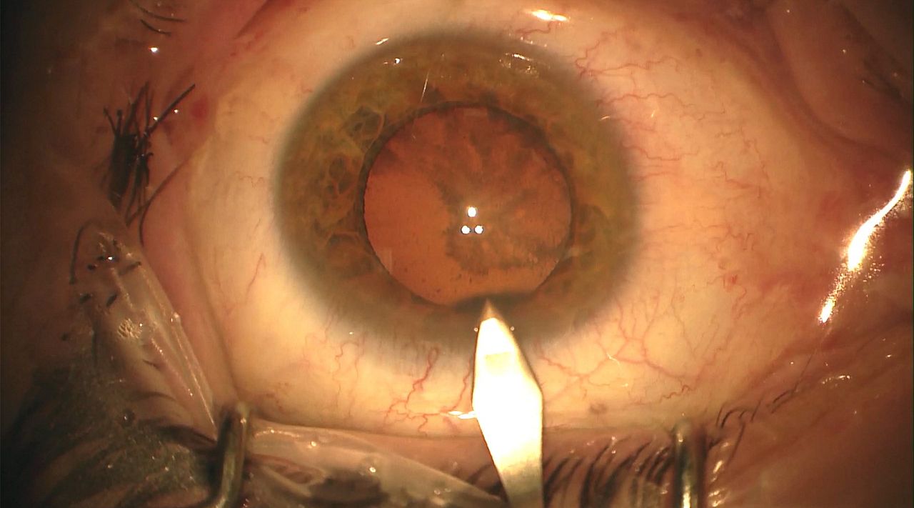 A História do Olhar : Fotos